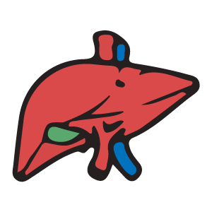 Long-term effects of alcoholism on the liver